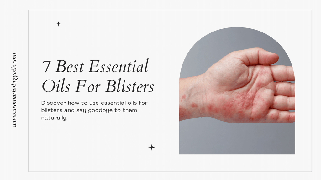 Essential Oils for Blisters - Aromachology Oils